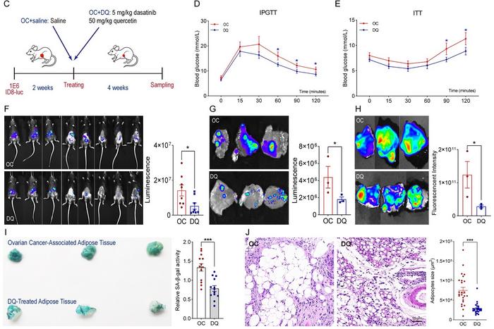 Targeting Senescent ADSCs in Adipose Tissue: Tongji University Team Paves New Way for Ovarian Cancer Therapy