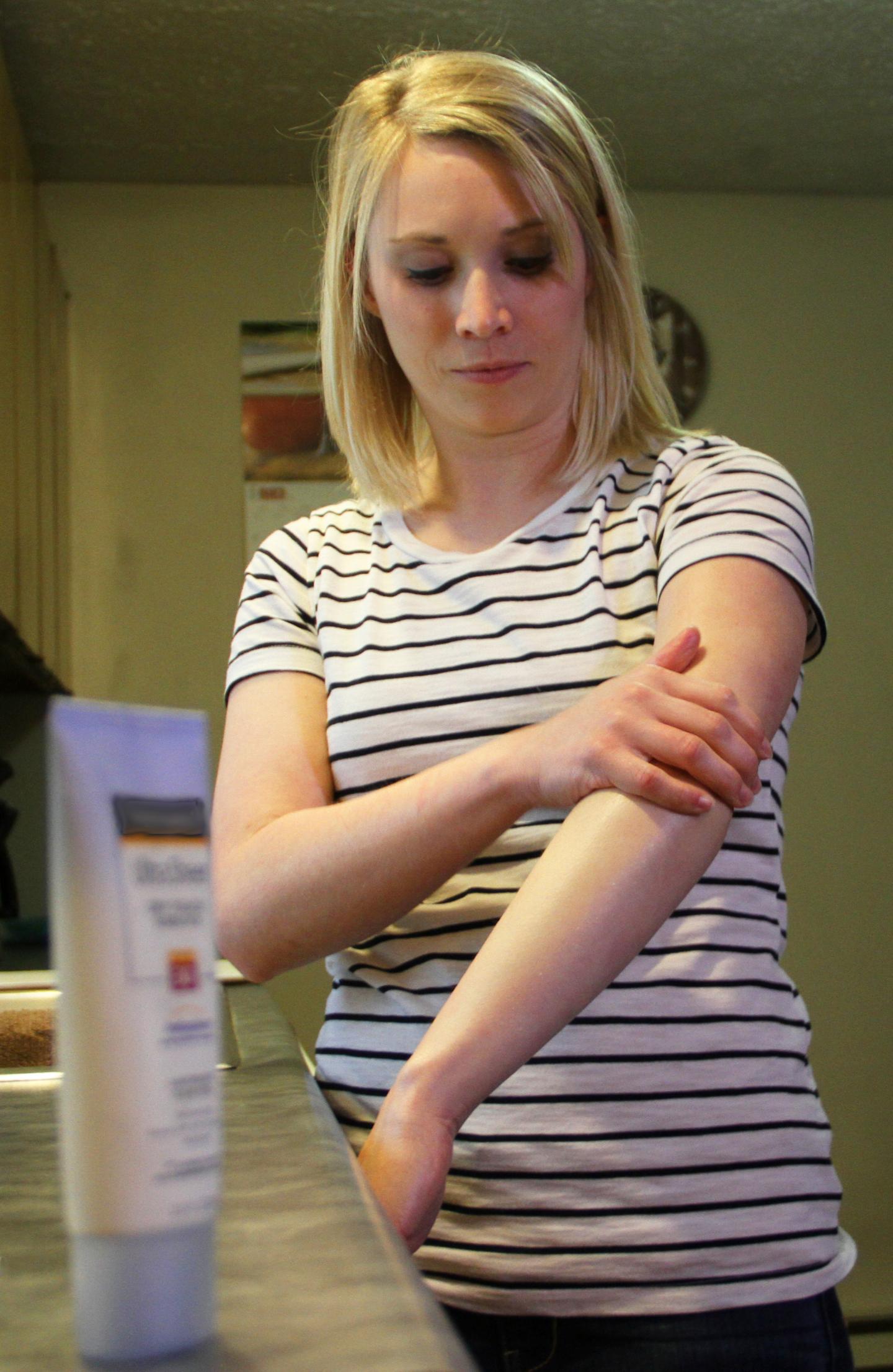 Melanoma Survivor Kelly Haldeman