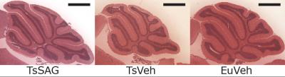 Sonic Hedgehog Drug Improves Down Syndrome Symptoms in Mice (1 of 1)
