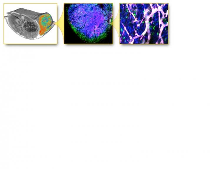 Predicting Response to Nanotherapeutics