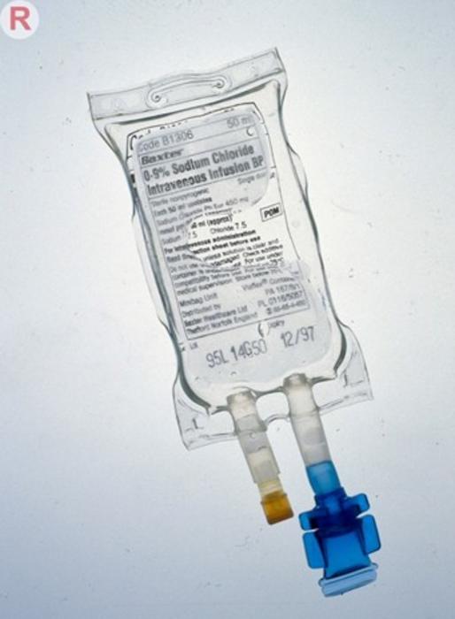 Tailored fluid resuscitation therapy for patients with septic shock