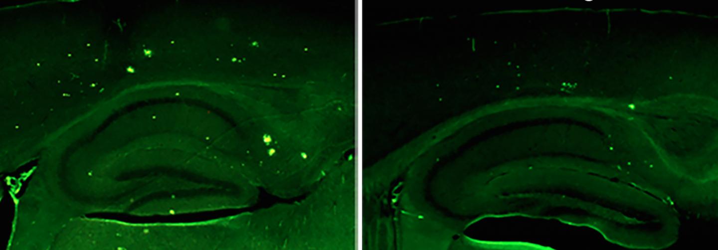 Elevating Brain Protein Allays Symptoms of Alzheimer's and Improves Memory
