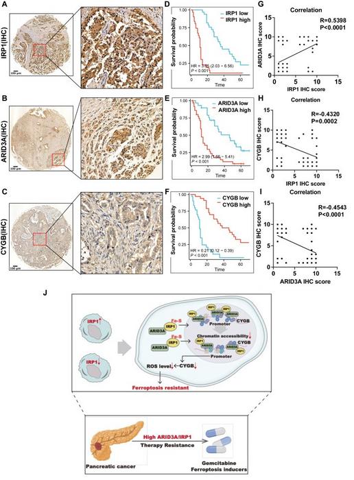IRP1-ARID3A-CYGB axis plays an important role in PCa.