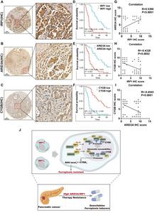 IRP1-ARID3A-CYGB axis plays an important role in PCa.