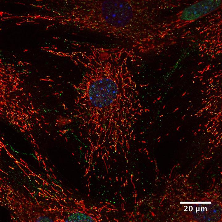 Mitochondrial Network in Human Fibroblasts