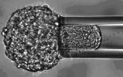 Tissue Apsiration Test