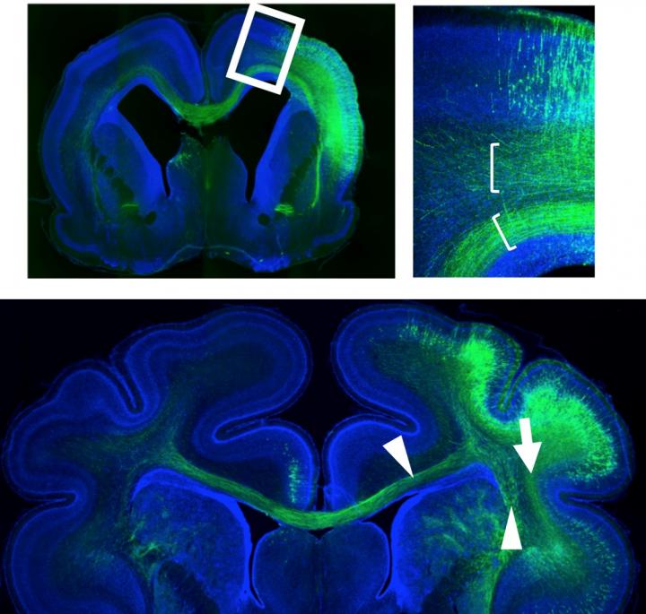 Figure 1. Two Axonal Fiber Layers Found in the Ferret Cerebrum and Difference in Their Destinations