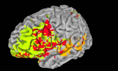 Mapping Intelligence and Executive Function