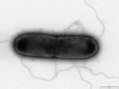<i>Clostridium difficile</i> Cell with Flagella