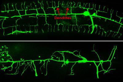 Dendrites