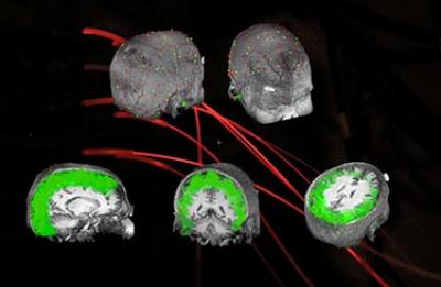 Detecting Brain Waves with EROS