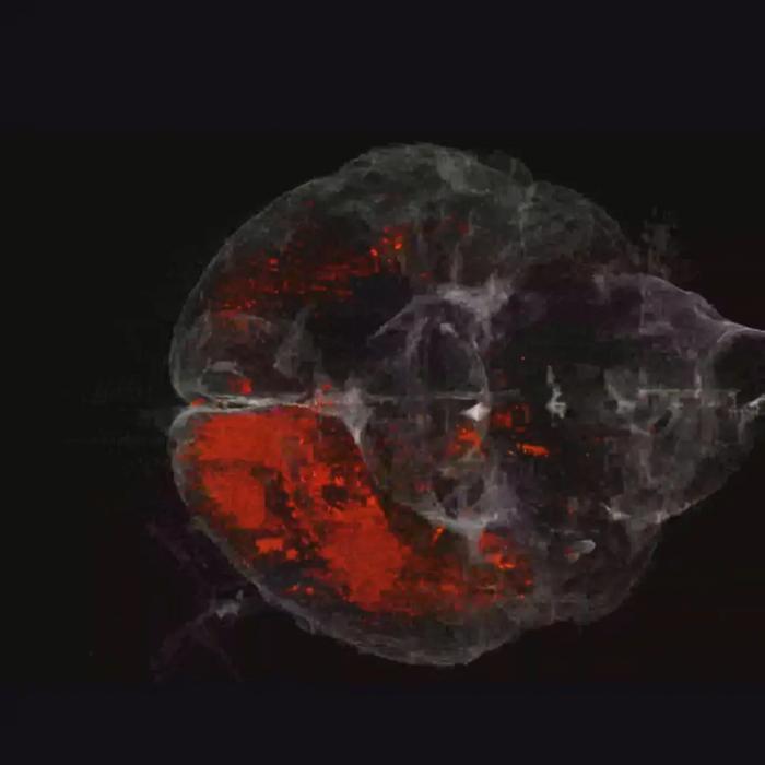 West Nile Virus infection in mouse brain