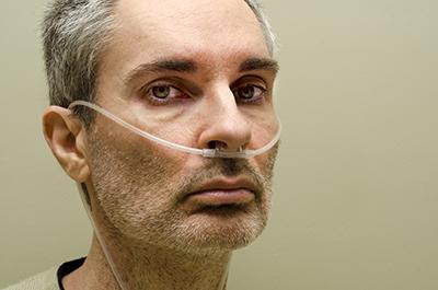 EBV for Severe Emphysema