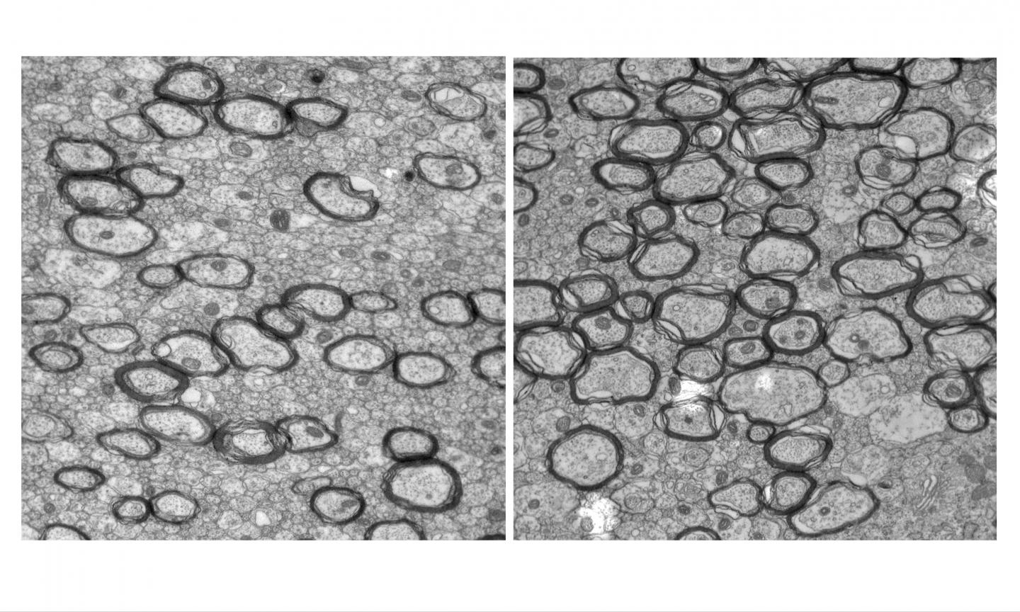 Cerveau sans traitement et avec traitement
