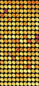 Kidney lipidomics cross section