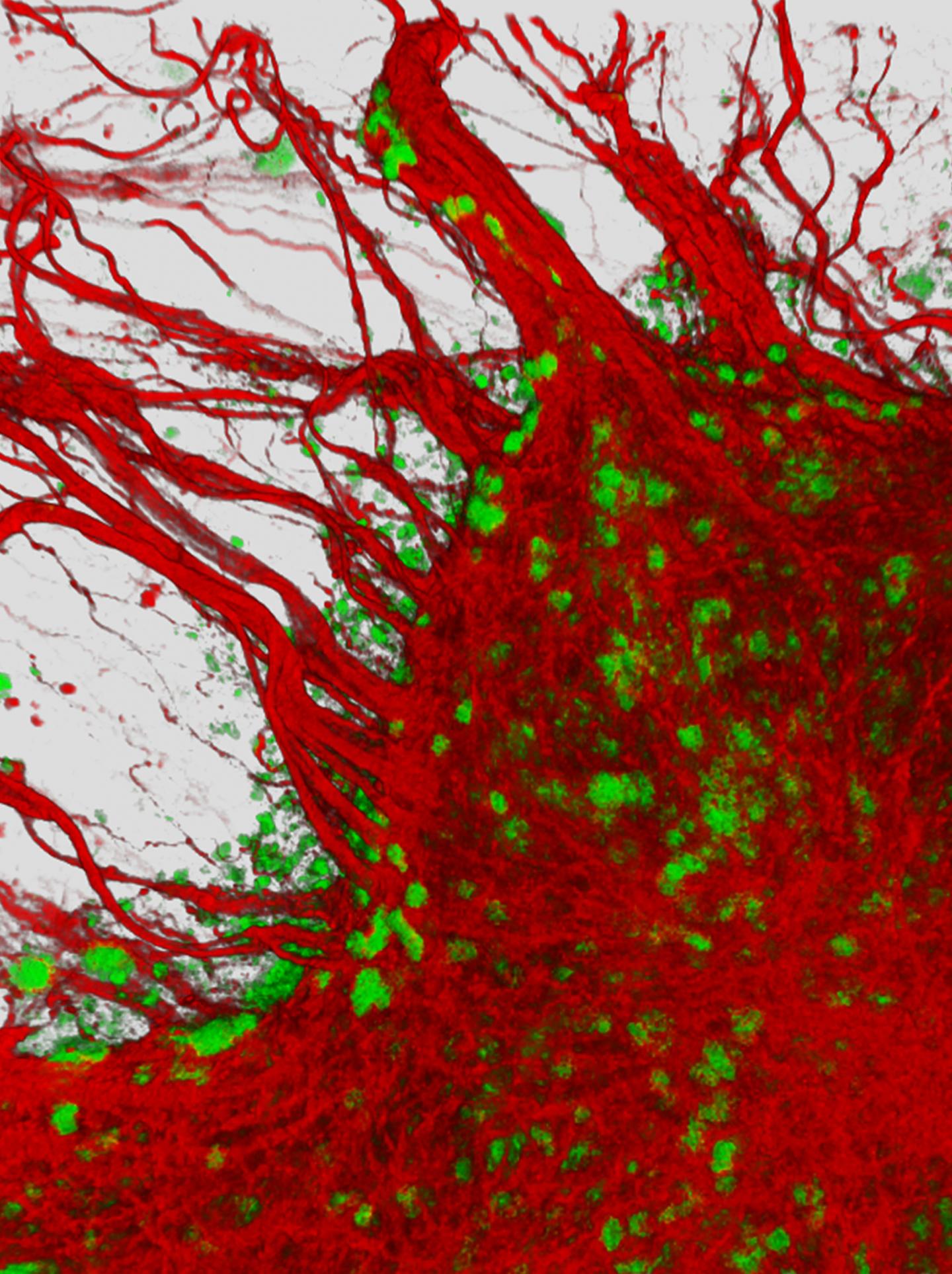 Human Neurons