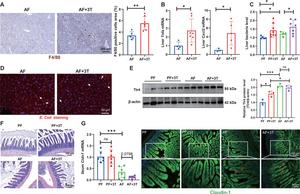 High-dose taurine supplementation exacerbated liver inflammation and bacterial translocation.