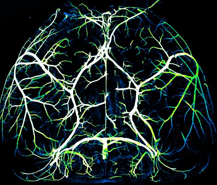 Arteries in the Brain