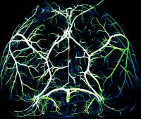 Arteries in the Brain
