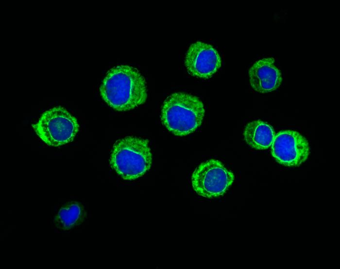 leukemic-cells-fluor