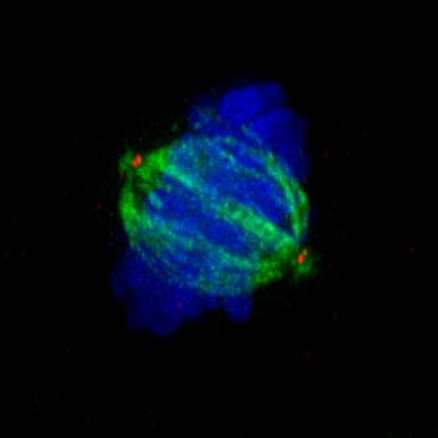 Normal Separation of Chromosomes