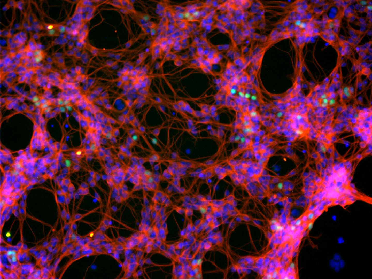 Interneurons