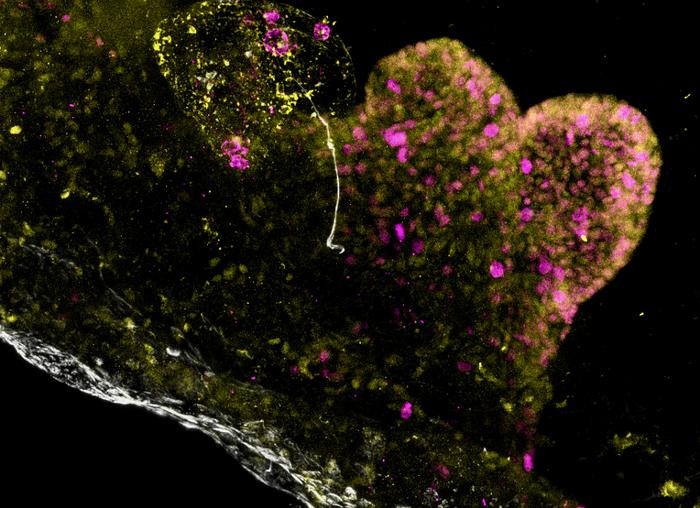 Multi-regional assembloid derived from PMM2 patients