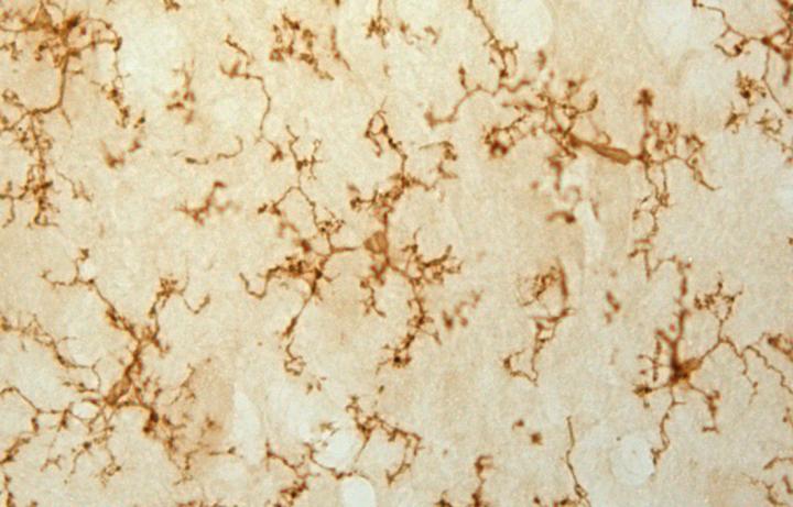 Microglial Cell Stained with antiCD11b Antibody