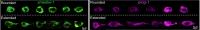 Image B Both Stem Cells