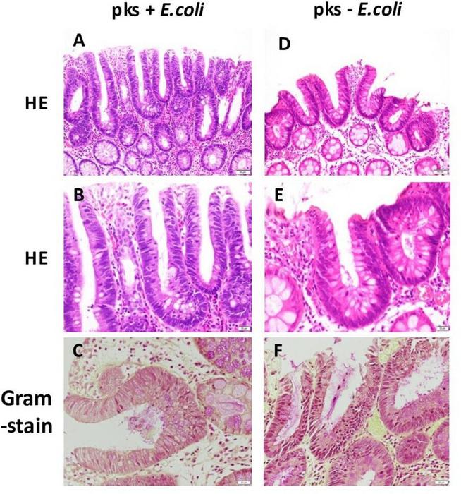 Representative histopathology of the polyps.
