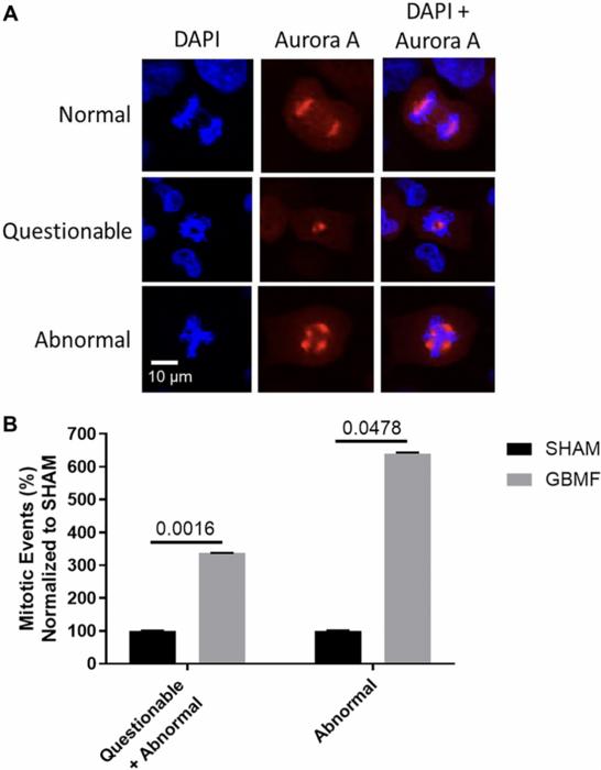 Treatment of glioblastoma with tumor-specific amplitude-modulated radiofrequency electromagnetic fields