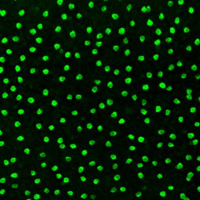 Cholinergic Amacrine Cells
