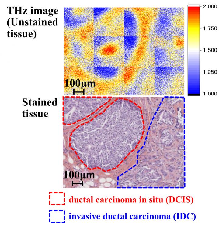 Unstained Tissue