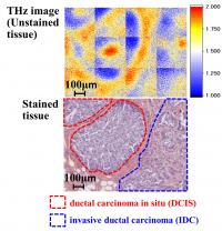 Unstained Tissue