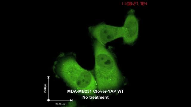 Blocking NUAK2 Halts Cancer Genes