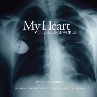 My Heart vs. the Real World