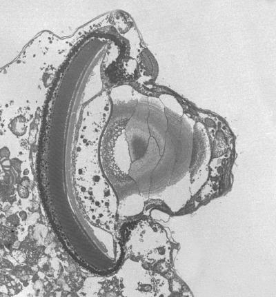Transmission Electron Micrograph of the Eye-Like Structure