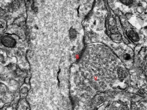 Mouse Brain Tissue