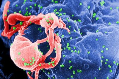 HIV-1 Virus