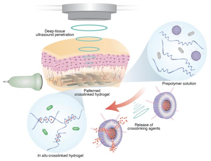 3D Printing In VIvo Using Sound