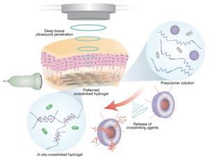 3D Printing In VIvo Using Sound