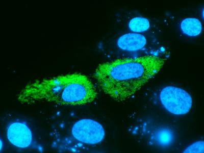 Gene Therapy Image