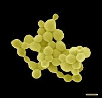 Image of the Gold Nuggets