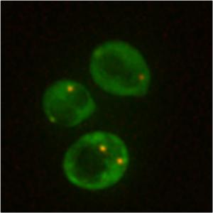 Yeast PR2_Riya Dhage