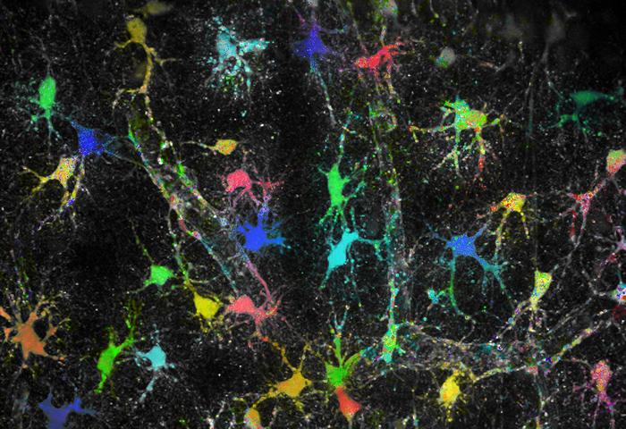 Astrocytes in brain tissue