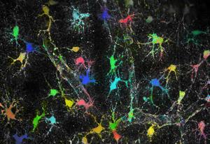 Astrocytes in brain tissue