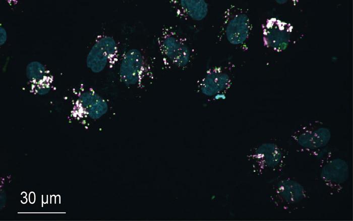 Disruption of cellular lysosomal function by tetrandrine: a naturally occurring alkaloid