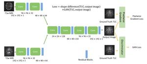 A progressive evolution in virtual MRI imaging for tumour detection