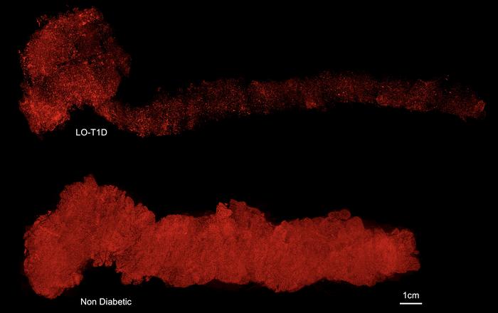 3D images of entire human pancreases