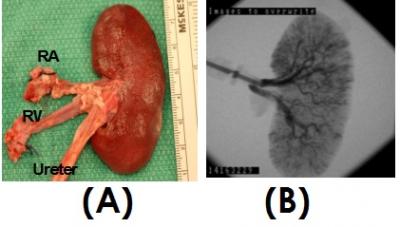 Harvested Kidney Construct